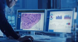 Digital Pathology Market to See Revolutionary Growth | Visiopharm , Huron Digital Pathology